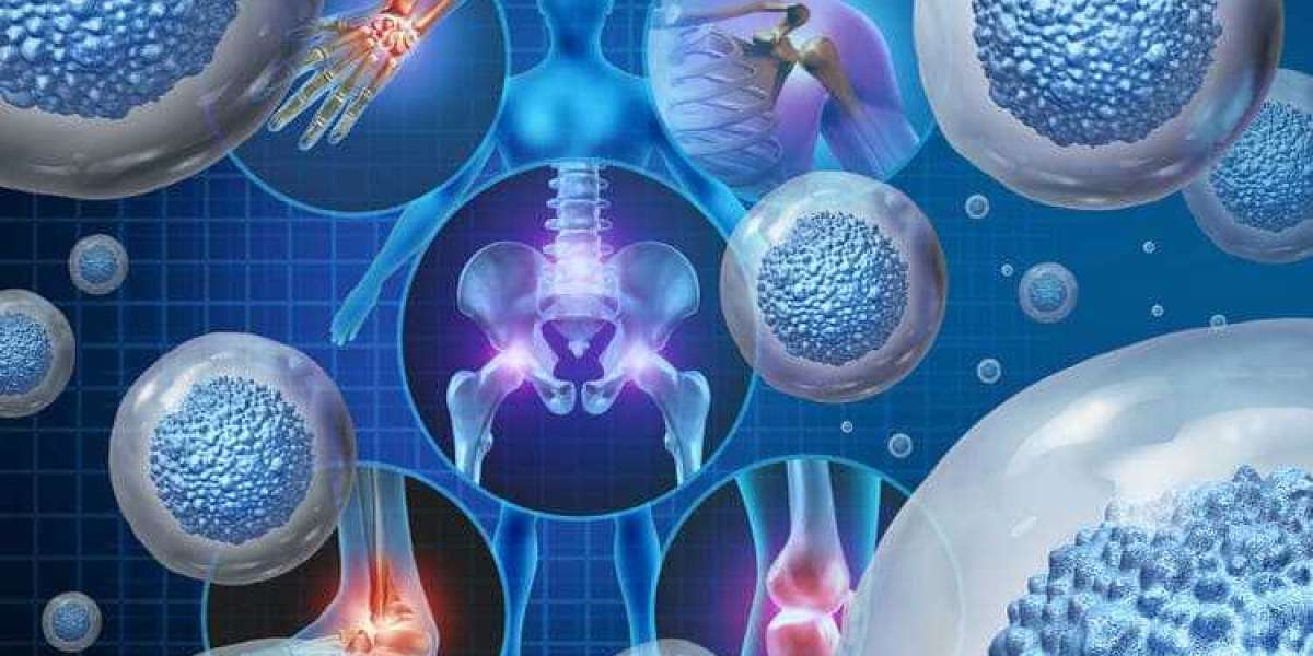 Stem Cell Therapy in New York: A Modern Solution for Pain and Healing