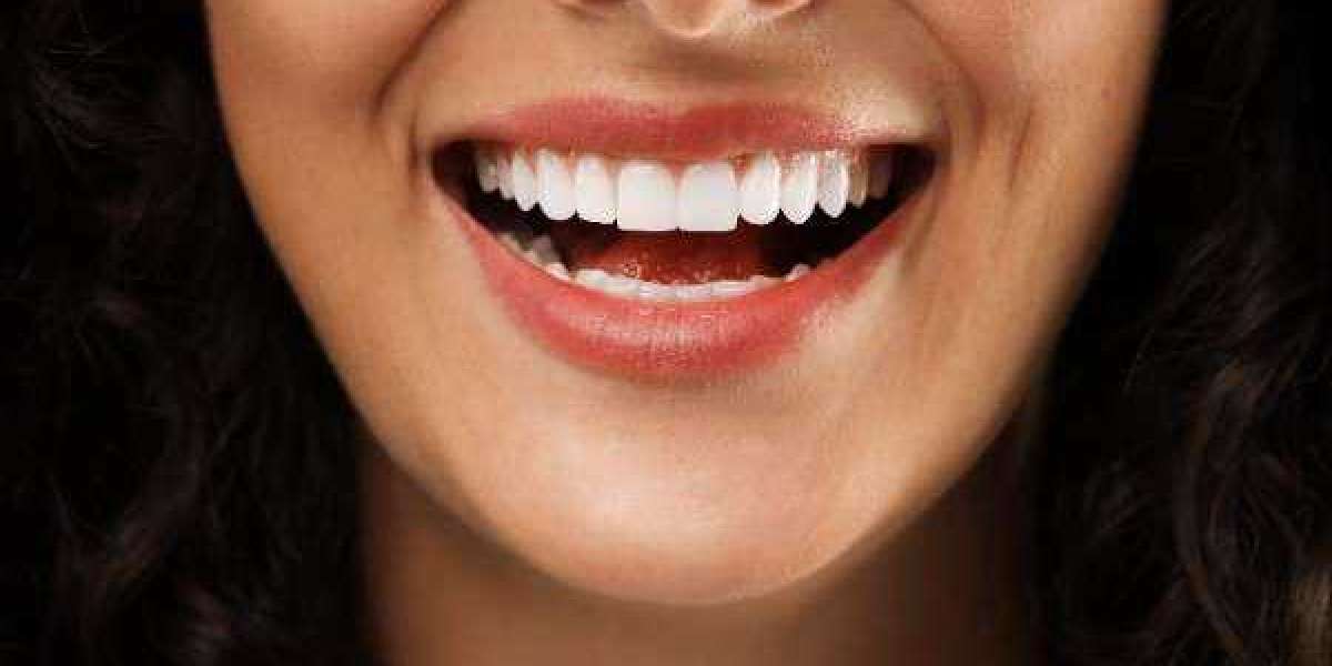 Subtle Aligner Options That Fit Your Image in Blackburn