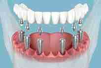 Image Source - Emergency Dentist Wrexham
