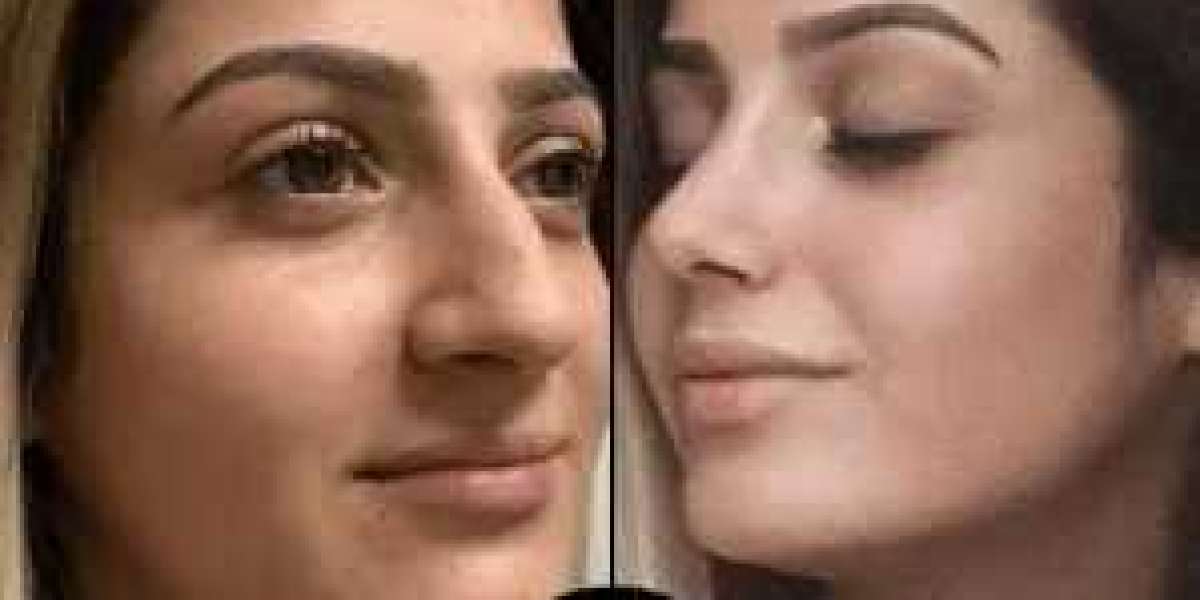 My Honest Review of the Best Aesthetic Clinic in Dubai